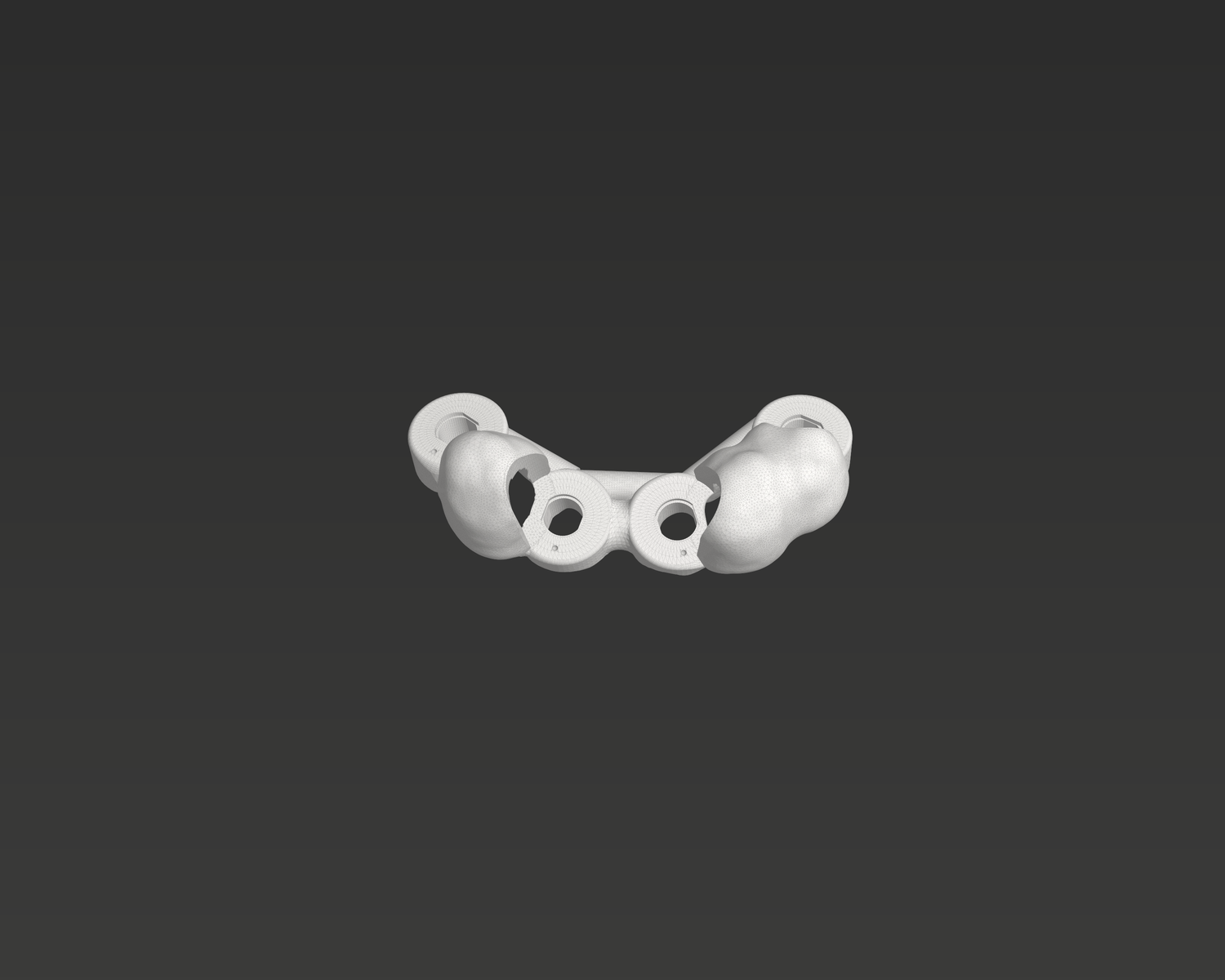Simulated tooth-supported surgical guide for multiple implants