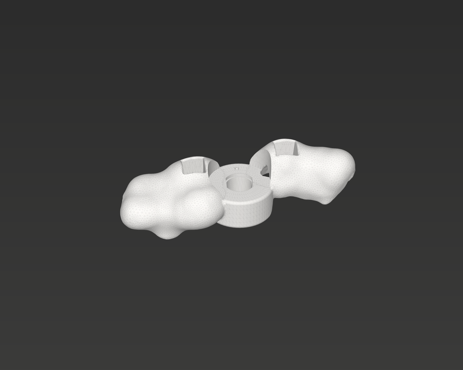 Simulation of a tooth-supported single implant guide